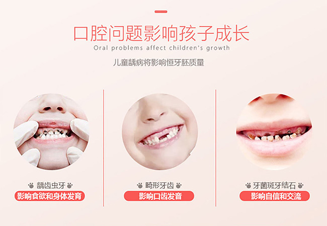 懶貝貝360°兒童電動(dòng)牙刷4_04.jpg 懶貝貝360°兒童電動(dòng)牙刷4_04.jpg