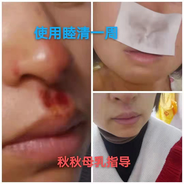 �����澏���N���Æ������M(f��i)�߿ڱ���������(sh��)���a(ch��n)ƷȦ�۟o��(sh��)